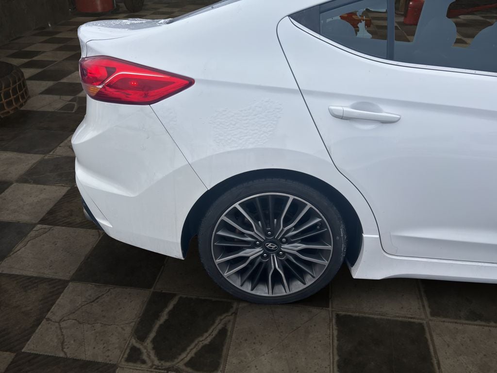 2018 Hyundai Elantra Sport